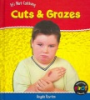 Cuts___grazes