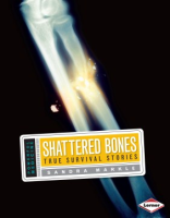 Shattered_bones